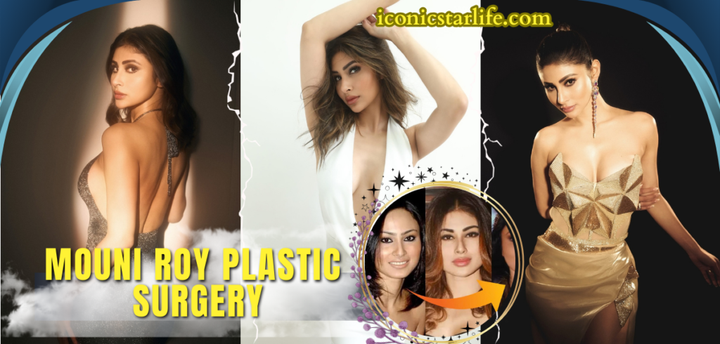 Mouni Roy Plastic Surgery